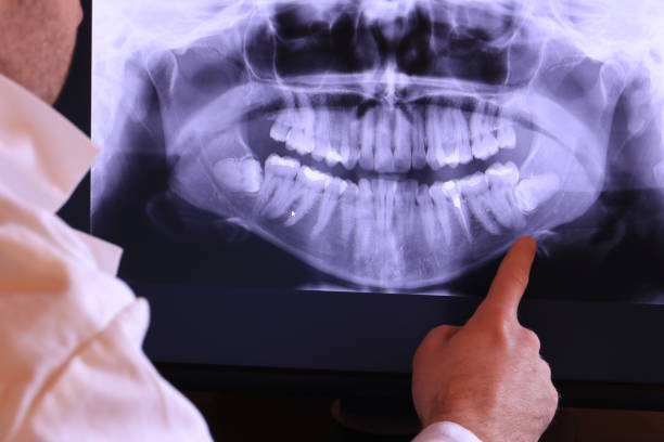 Best Broken or Chipped Tooth Repair in Fort Defiance, AZ